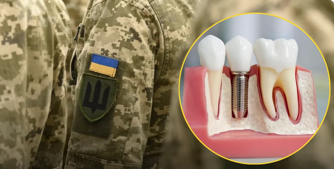 Зубопротезування для УБД