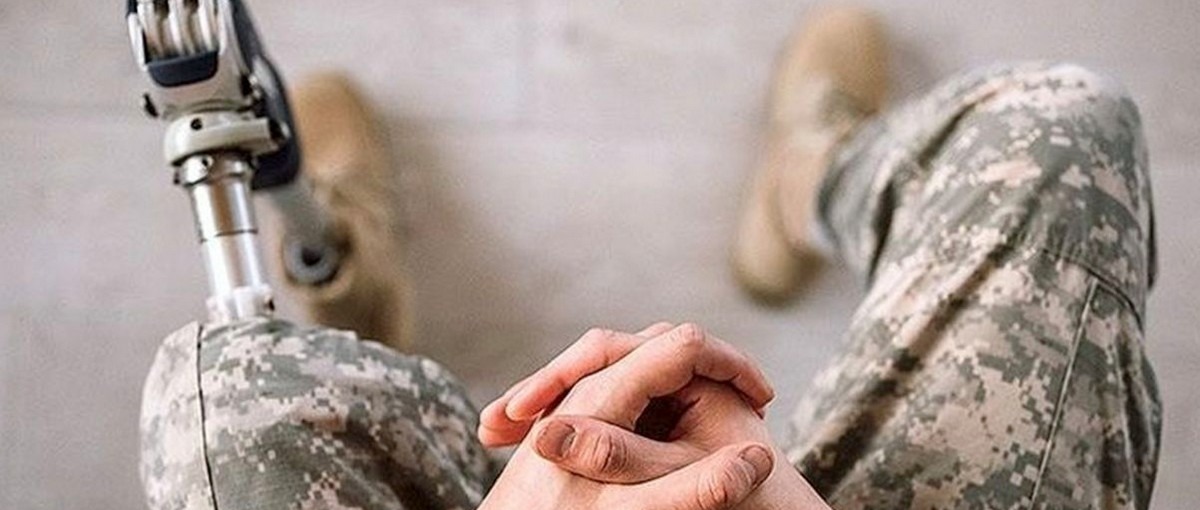 Протезування для ветеранів: порядок, підприємства та важливі нюанси